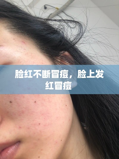 脸红不断冒痘，脸上发红冒痘 
